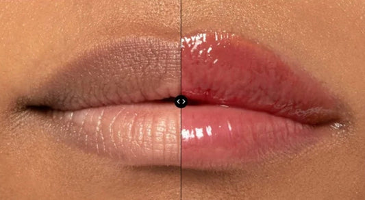 How to Naturally Achieve 1ml lip filler Without Injections